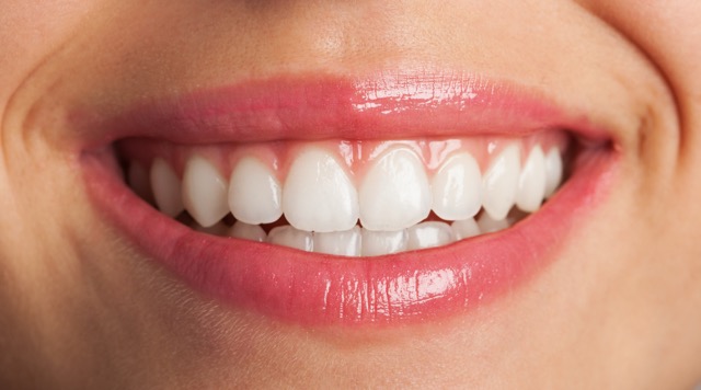 Blanqueamiento Dental. Consejos y Preguntas