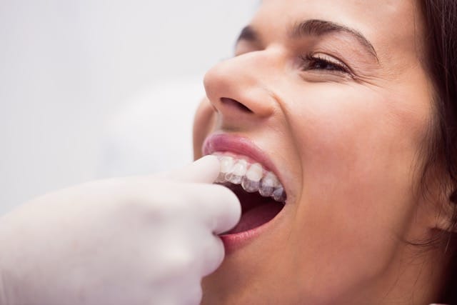 Férula de descarga personalizada fabricada en Instituto Dental ABAD, Murcia